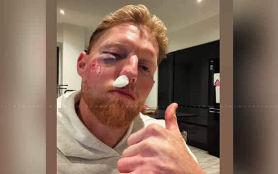 Ben Stokes suffers BRUTAL face injury; Know how he got injured