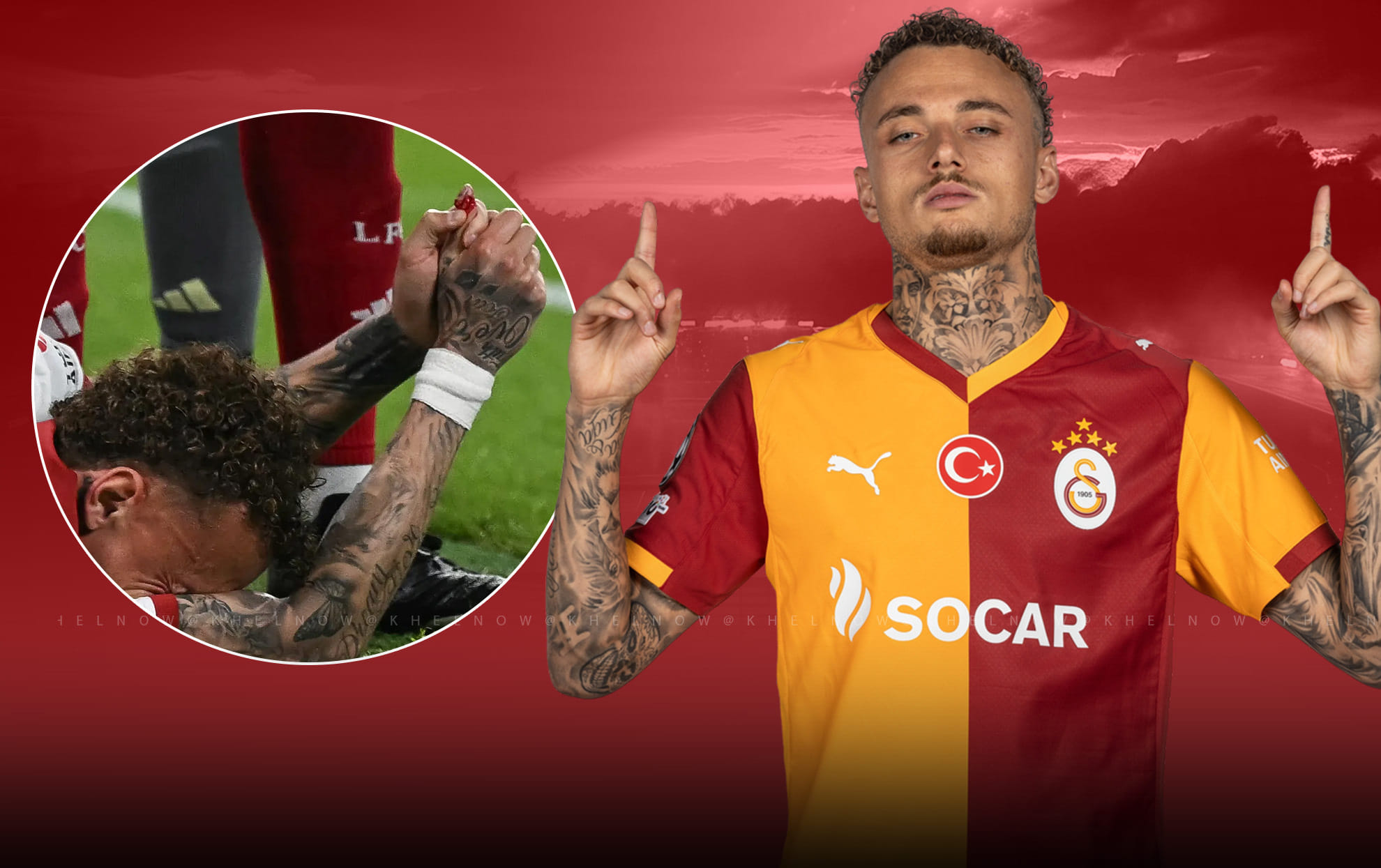 How did Galatasaray star Noa Lang suffer an unusual injury at Anfield?