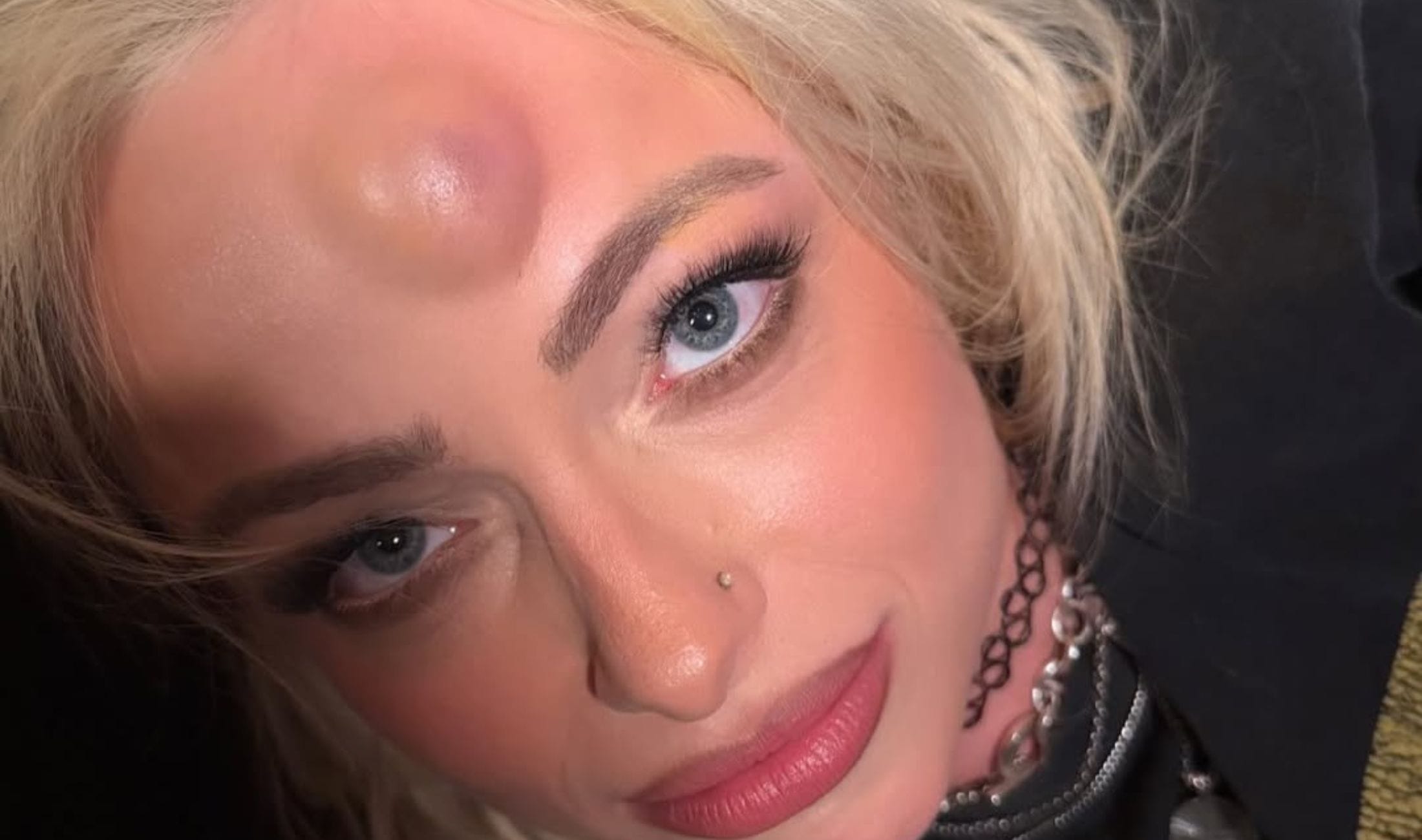 Could Liv Morgan miss WWE WrestleMania 42 after being placed in concussion protocol?